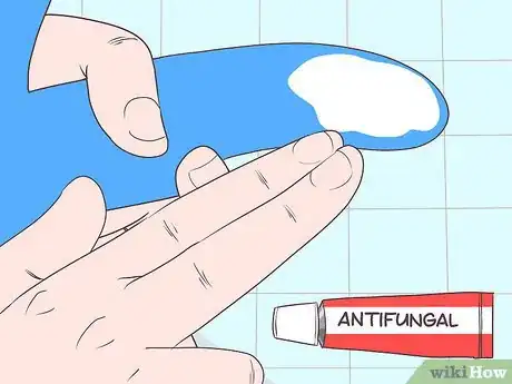 Image titled Cure Balanitis Step 4