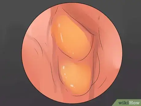 Image titled Diagnose a Cat Cough Step 14