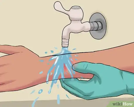 Image titled Use a Band Aid Step 12