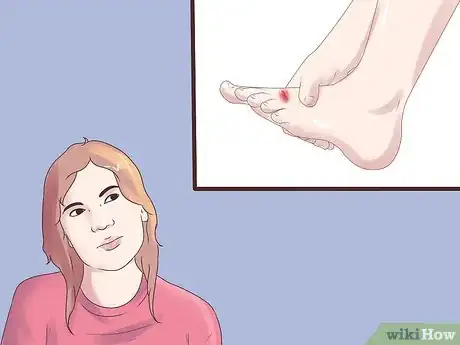 Image titled Recognize the Symptoms of Neuromata Step 24