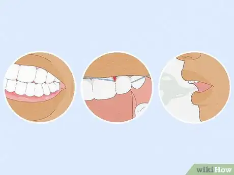 Image titled Manage Dental Health with Rheumatoid Arthritis Step 4