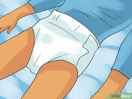Image titled Change a Disposable Pull‐Up Style Adult Diaper Step 2