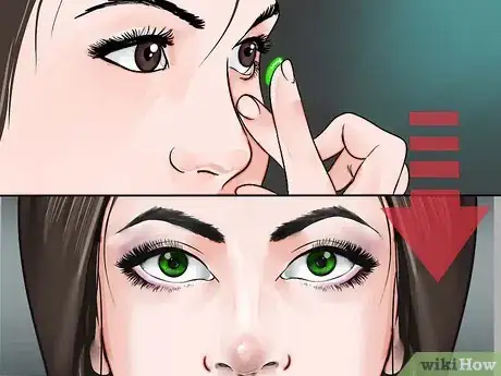 Image titled Care for Dry Eyes Step 1