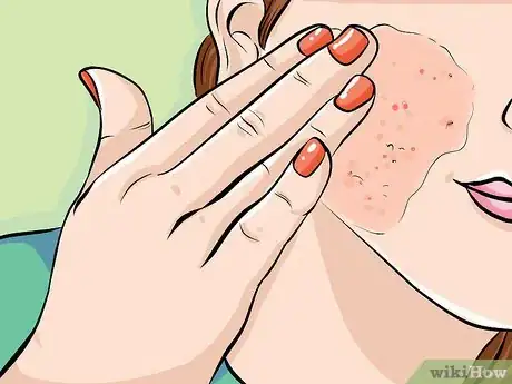 Image titled Use Tomatoes to Get Healthy Skin Step 4