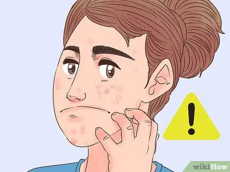 Image titled Use Bio Oil Step 5