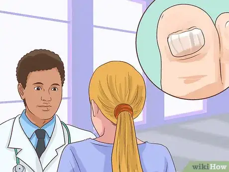 Image titled Treat a Torn Toenail Step 14