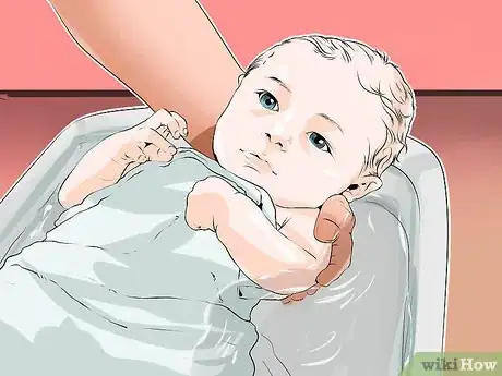 Image titled Treat Eczema in Children Step 2