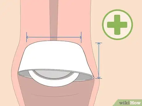 Image titled Use a Cervical Cap Step 2