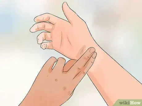 Image titled Diagnose Aortic Regurgitation Step 3