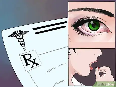 Image titled Care for Dry Eyes Step 6