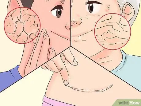 Image titled Use Bio Oil Step 4