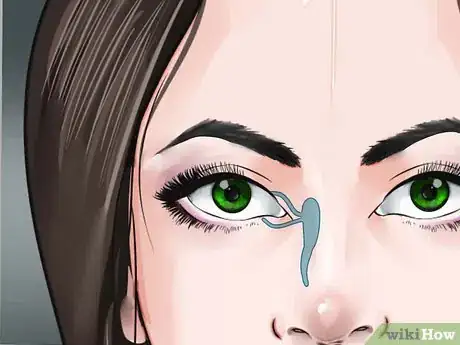 Image titled Care for Dry Eyes Step 16