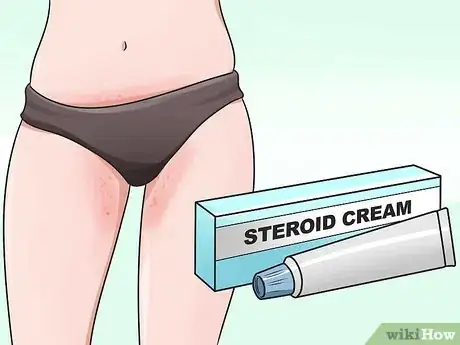 Image titled Stop Vaginal Itching Step 19