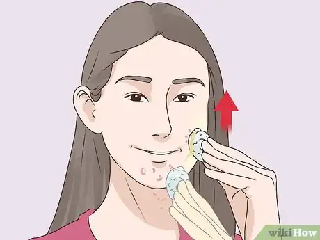 Image titled Make a Lemon Face Cleanser Step 22