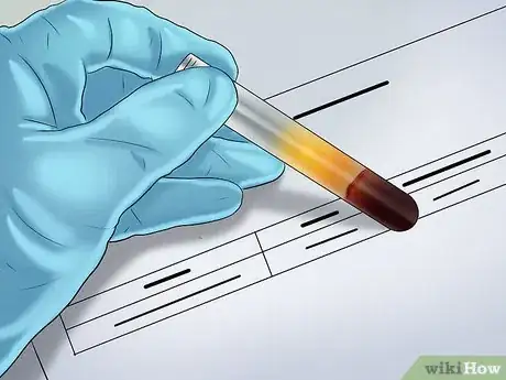 Image titled Study and Know About Liver Tests in Clinical Chemistry Step 7