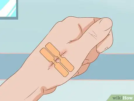 Image titled Apply Different Types of Bandages Step 19