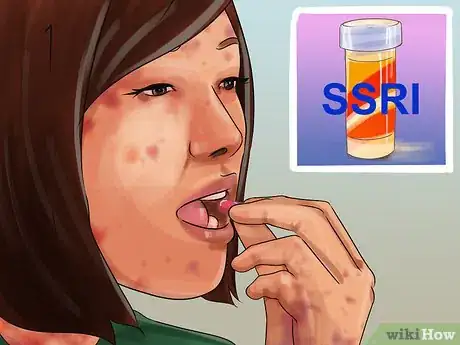 Image titled Stop Dermatillomania Step 2