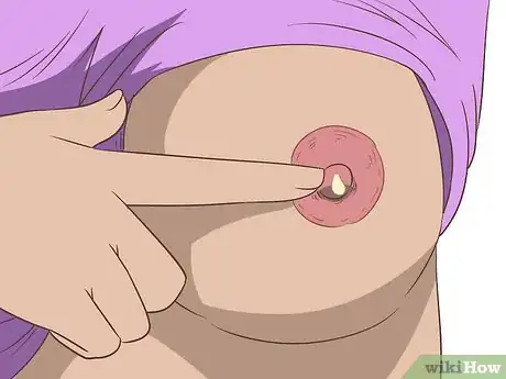 Image titled Treat Breast and Extramammary Paget's Disease Step 12