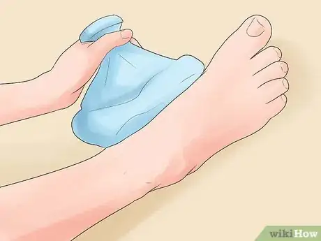 Image titled Treat Swelling Step 3