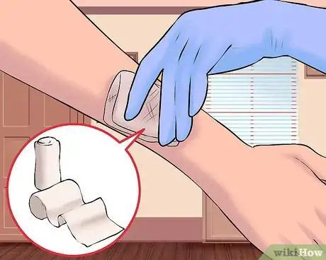 Image titled Use a Band Aid Step 11