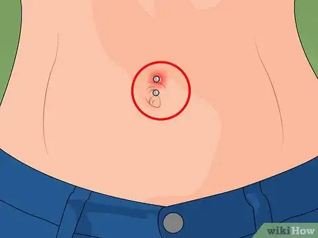 Image titled Care for a New Navel Piercing Step 13