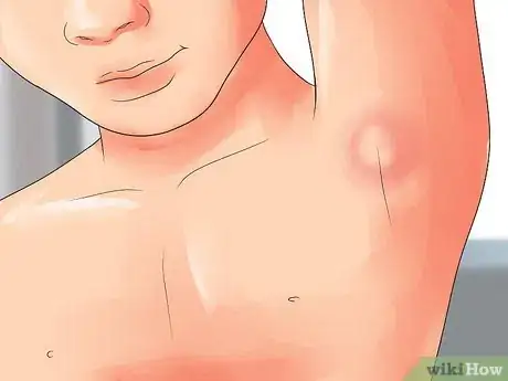 Image titled Prevent Leukemia in Children Step 17