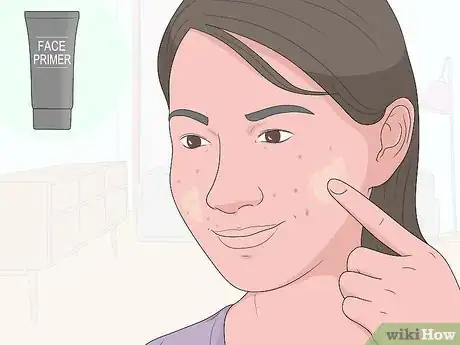 Image titled Get Rid of Acne Scars at Home Without Chemicals Step 7