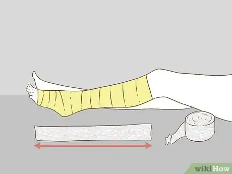 Image titled Apply Splints Step 16