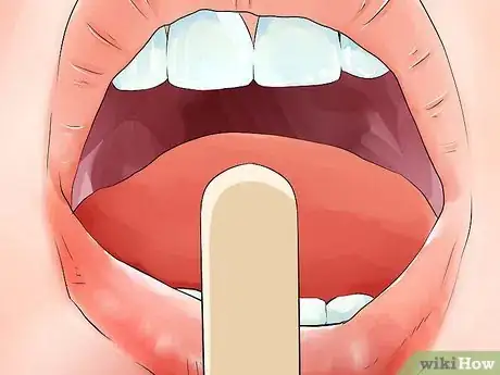 Image titled Diagnose and Treat Scarlet Fever Step 5