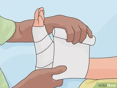 Image titled Treat a Foot Wound Step 05