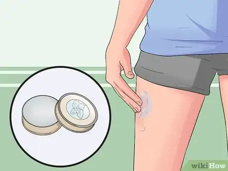 Image titled Apply Balm to Cramped Muscles Step 1