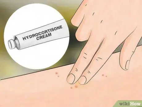 Image titled Identify Fire Ant Stings Step 7