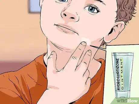 Image titled Treat Eczema in Children Step 9