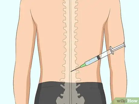 Image titled Prevent and Manage Sciatic Pain Step 15