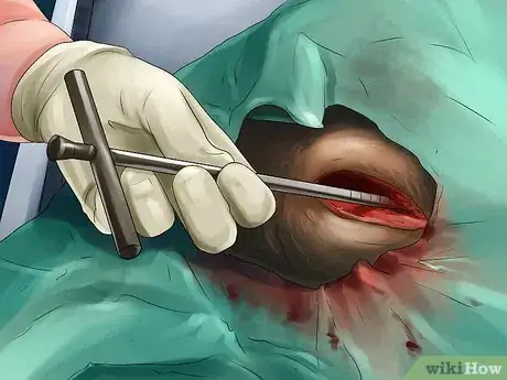 Image titled Treat a Dog with Osteosarcoma Step 4