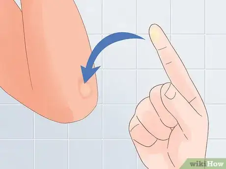 Image titled Use Emu Oil for Health and Skin Benefits Step 2