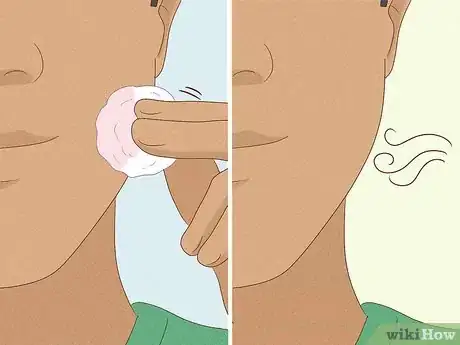 Image titled Clean Your Face to Prevent Pimples Step 13