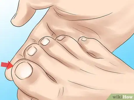 Image titled Keep Your Nails Healthy Step 18