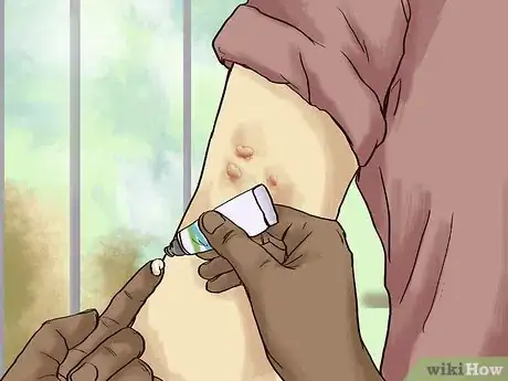 Image titled Care for a Tattoo During Removal Step 5