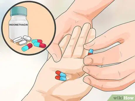 Image titled Stop a Severe Headache After a Long Run Step 2