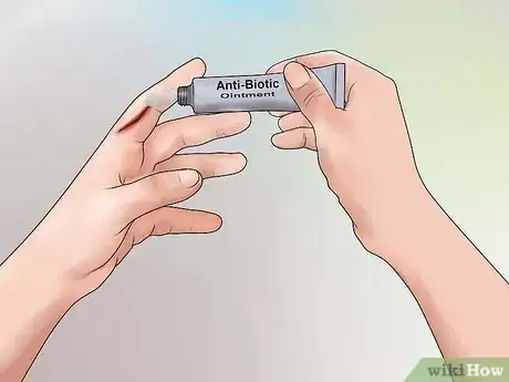 Image titled Stop Mild Bleeding During First Aid Step 6