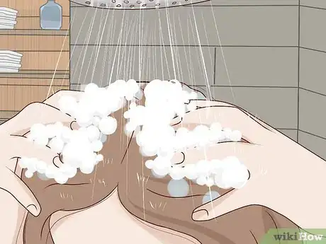 Image titled Get Rid of Dandruff at Home Step 7