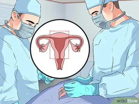 Image titled Treat Cervical Cancer Step 4