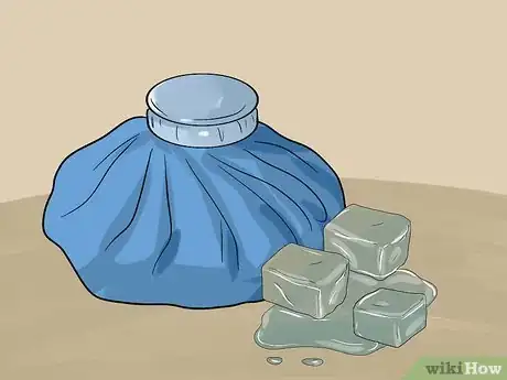 Image titled Get Rid of Hemorrhoids Step 5