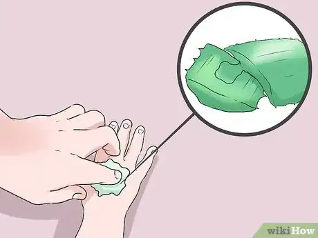 Image titled Treat Burns in Infants Step 4