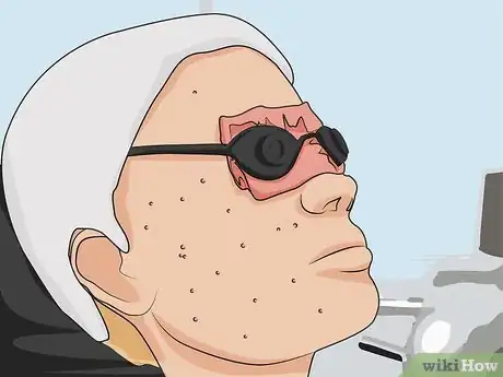 Image titled Use Blue Light Acne Treatment Step 07