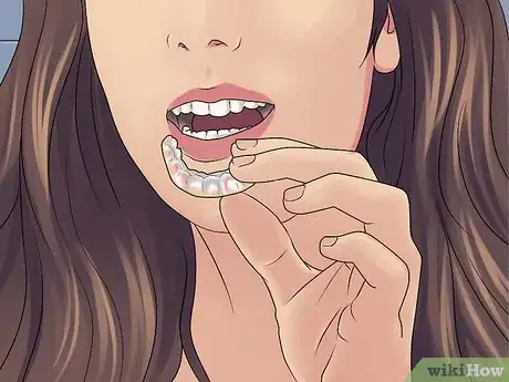 Image titled Treat TMJ Headaches Step 16