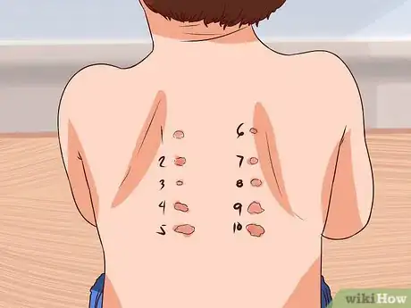 Image titled Manage Tuberculosis Step 9