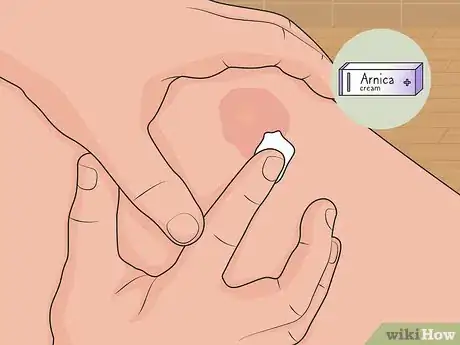 Image titled Use Arnica for Natural Remedies Step 04