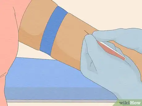 Image titled Get Ovarian Reserve Testing Done Step 6